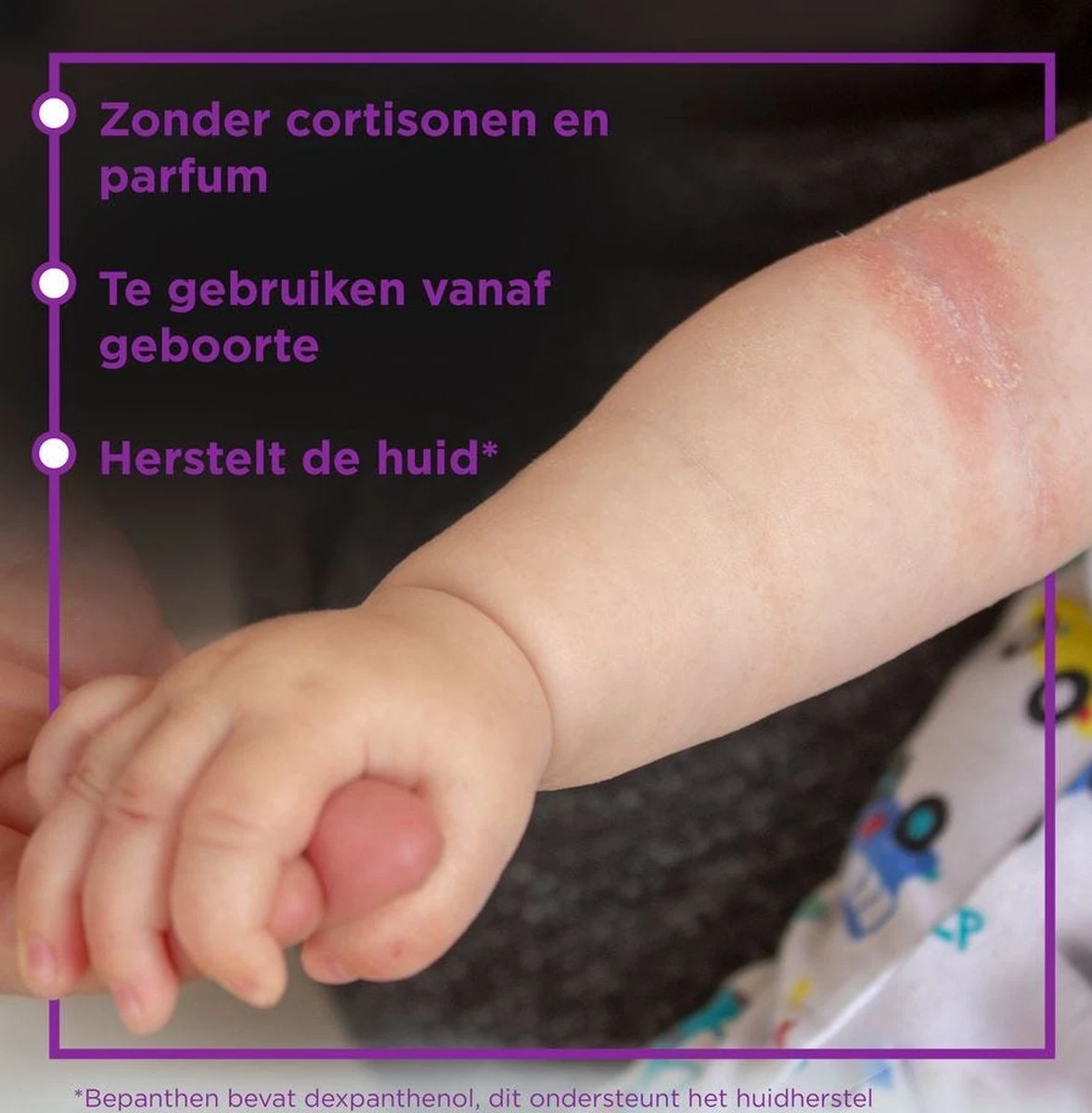 Bepanthen Eczeem Creme - Verlicht Jeuk En Roodheid - Mild Tot Matig Atopisch Eczeem - Ook Bij Babies - 20 Gram - Afbeelding 2