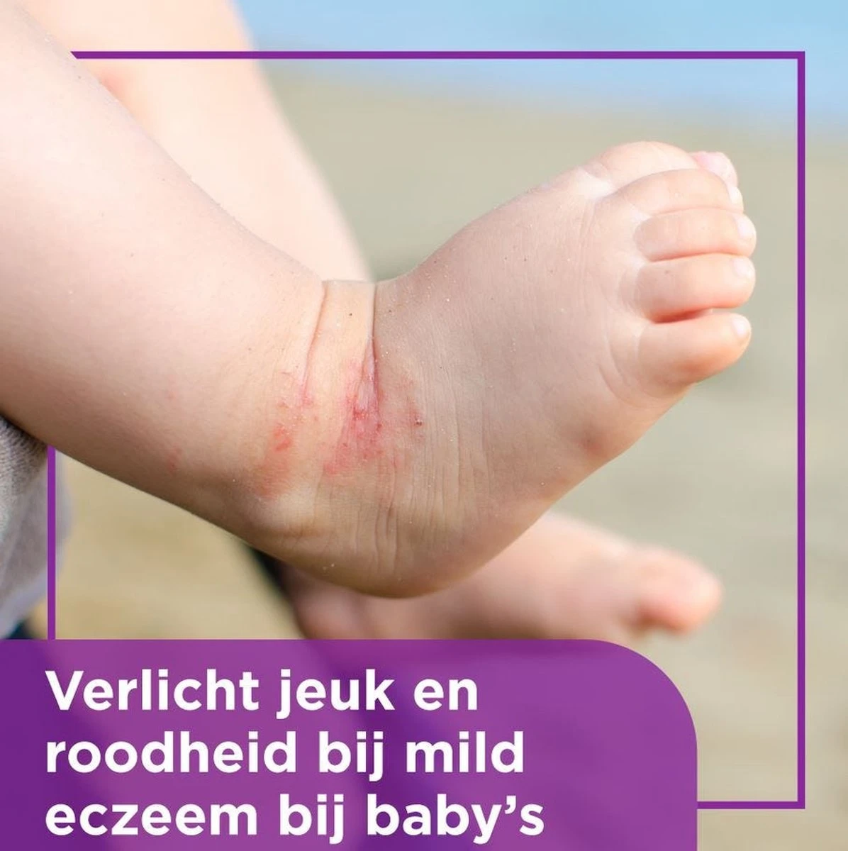 Bepanthen Eczeem Creme - Verlicht Jeuk En Roodheid - Mild Tot Matig Atopisch Eczeem - Ook Bij Babies - 20 Gram - Afbeelding 4