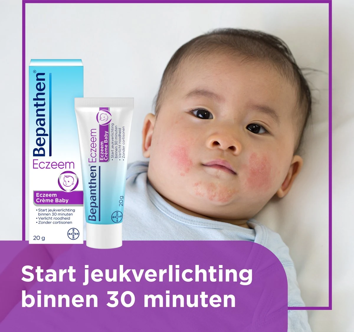 Bepanthen Eczeem Creme - Verlicht Jeuk En Roodheid - Mild Tot Matig Atopisch Eczeem - Ook Bij Babies - 20 Gram - Afbeelding 7