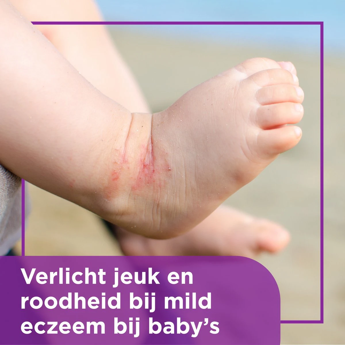 Bepanthen Eczeem Creme - Verlicht Jeuk En Roodheid - Mild Tot Matig Atopisch Eczeem - Ook Bij Babies - 20 Gram - Afbeelding 5