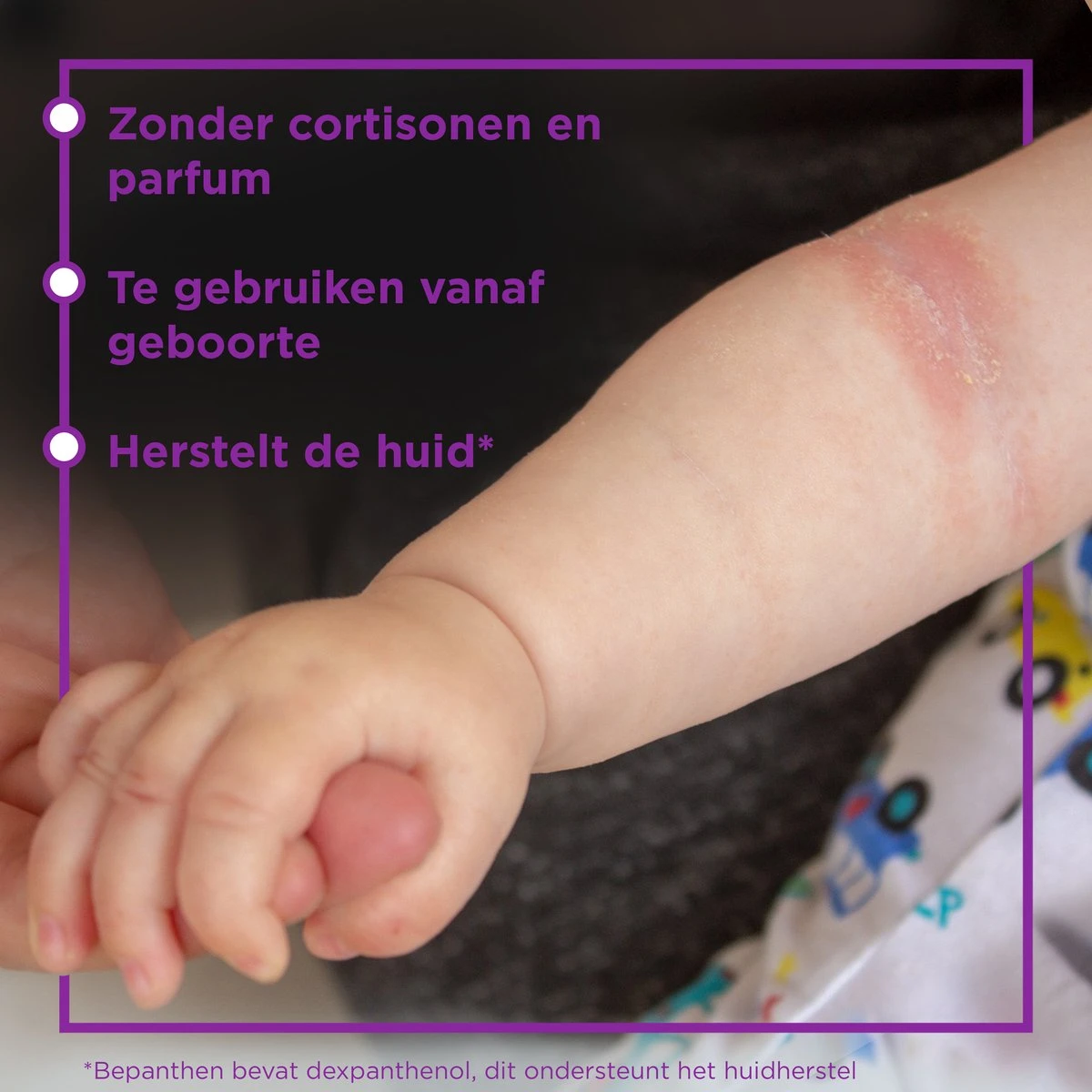 Bepanthen Eczeem Creme - Verlicht Jeuk En Roodheid - Mild Tot Matig Atopisch Eczeem - Ook Bij Babies - 20 Gram - Afbeelding 6
